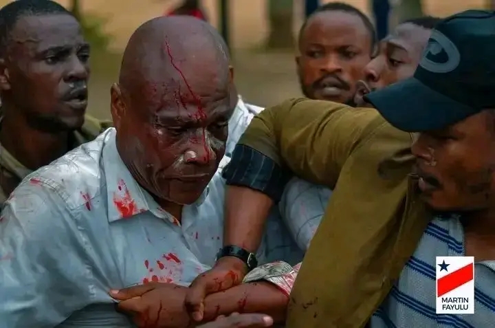 RDC : Martin Fayulu blessé lors du sit-in de l'opposition à Kinshasa !